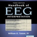 Handbook of EEG Interpretation, Third Edition – A Comprehensive EEG Book for Neurology Residents and Fellows, Clinicians, and Technologists – 3rd Edition