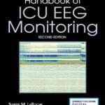 Handbook of ICU EEG Monitoring – 2nd Edition