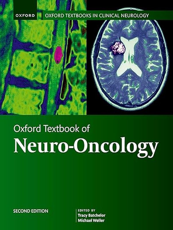 oxford-textbook-of-neuro-oncology-oxford-textbooks-in-clinical-neurology-603x800-1.jpg Oxford Textbook of Neuro-Oncology (Oxford Textbooks in Clinical Neurology) - Image 1